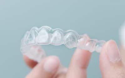 What to Expect During Clear Aligner Treatment