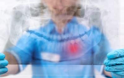 What Do You Need to Know Before Root Canal Therapy?